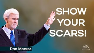 Show Your Scars! | Don Meares