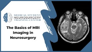 The Basics of MRI Imaging in Neurosurgery