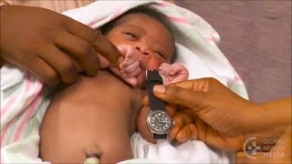 Fast Breathing as the Single Sign of Illness - Newborn Care Series