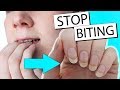 15 WAYS TO STOP BITING YOUR NAILS | Nailed It NZ 15 WAYS TO STOP BITING YOUR NAILS | Nailed It NZ