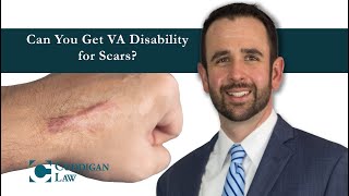 Can You Get VA Disability for Scars?