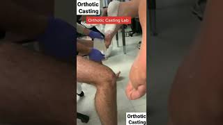 Orthotic Casting |Foot orthosis| #orthotics #orthosis #orthoticshoes #foot #prosthesis  #orthosis