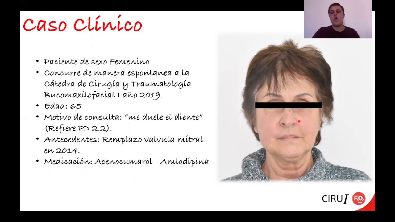 Preoperatorio. Seminario B. Caso Clínico - YouTube