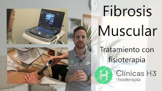 Fibrosis muscular ¿Qué es? ¿Cuál es el mejor tratamiento? | Clinicas h3 fisioterapia