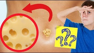Making CHEESE from Belly Button Bacteria?!