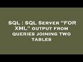 SQL : SQL Server 