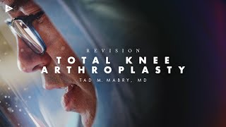 Revision Total Knee Arthroplasty for Aseptic Loosening | Preview