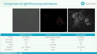 Label-free 3D Live Cell Imaging and Quantification using Holotomography