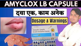 Amyclox LB Capsule Review | Amoxycillin , Cloxacillin \u0026 Lactic Acid Bacillus Capsules Uses In Hindi