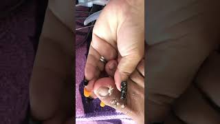 Ang laki ng ingrown #pedicure #everyone  #subscribe #satisfying