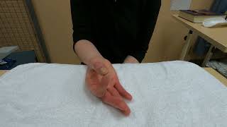 Hand injury exercise 14: Active thumb opposition