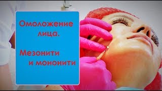 Лифтинг. Иголки в лицо. Жутковатое зрелище, но красота требует жертв)))