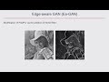 ohbm 2024 symposium levente baljer leveraging gans for super resolution of ultra low field …