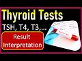 Thyroid Test | TSH, T4, T3 Tests Explained | Thyroid Test Report Interpretation