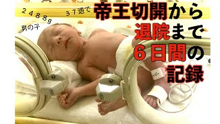 妊娠37週帝王切開で産まれた赤ちゃん#新生児　退院までの６日間に密着、新米パパの赤ちゃん成長記録【パパ育児】