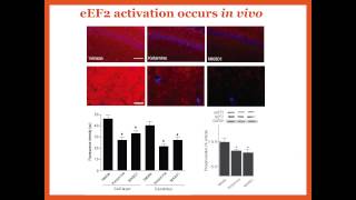 Mechanisms of Antidepressant Effects