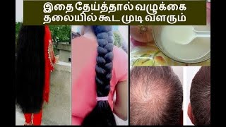 இதை தேய்த்தால் வழுக்கை தலையில் கூட முடி வளரும்||how to increase hair growth with onion juice