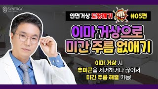 【이마거상으로 미간 주름 없애기】 - 시너지성형외과 안면거상 도장깨기 #05