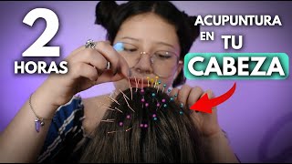 ASMR en ESPAÑOL 💆🏻‍♀️ 2 HORAS de ACUPUNTURA CEREBRAL para la ANSIEDAD🧠 📍 Vivalen ASMR