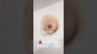 乳房再建しない乳がん人工乳房 メスを入れて痛い思いもうしません