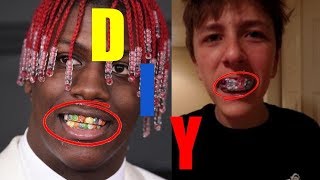 How to Make Your Own Lil Yachty Skittles Grillz (DIY)