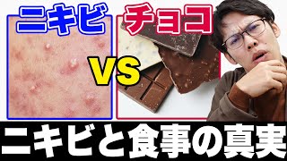 【研究者が解説】ニキビとチョコレートの真実