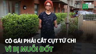 Cô gái phải cắt cụt tứ chi vì bị muỗi đốt | VTC14