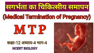 सगर्भता का चिकित्सीय समापन (Medical Termination of Pregnancy,  MTP)