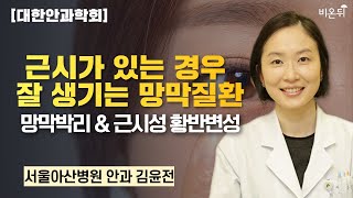 [대한안과학회] 근시가 있는 경우 잘 생기는 망막질환; 망막박리 & 근시성 황반변성 / 서울아산병원 안과 김윤전