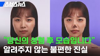 '성형 비포 애프터?' 성형정보 앱 회사에서 성형 부작용을 알리는 이유 / 스브스뉴스