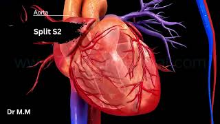 Split S2: The Sound of a Healthy Heart! ❤️ (Normal vs. Abnormal)