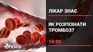 Тромбоз: чим небезпечні тромби і чому вони виникають?