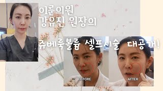 이룬의원 닥터강의 쥬베룩 볼륨 셀프시술 영상 대공개!!