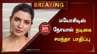 BREAKING | மயோசிடிஸ் நோயால் நடிகை சமந்தா பாதிப்பு..!