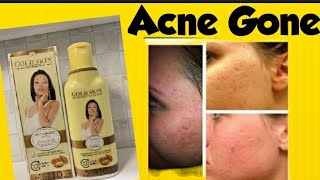 GOLD SKIN Fast Action Lightening Cream -RESULTS IN 10 DAYS