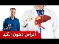 ماهي اول أعراض تراكم الدهون في الكبد | تشحّم الكبد