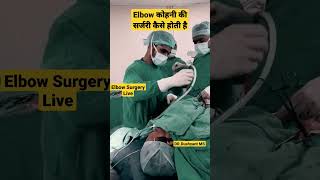 Elbow कोहनी की सर्जरी कैसे होती है | Elbow Surgery Live  Procedure | #elbowsurgery #elbowpain #mbbs