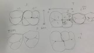 치아 형태학 3 (대구치 소구치)