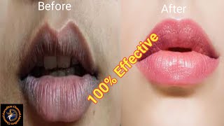 How to get pink lips? 100% effective home remedies | உதட்டின் கருமை நீங்க | Aarudhra Channel