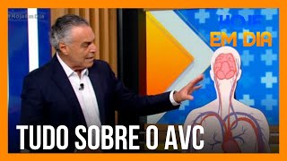 Você e o Doutor: Saiba tudo sobre o AVC