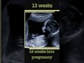 5-14 Weeks Embryo To Fetus Appearance On Ultrasound | ultrasound #shorts