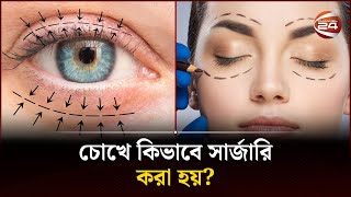 চোখে কিভাবে সার্জারি করা হয়? | Surgery | Eye | Channel 24