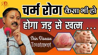 charm rog ki dava | skin disease ka ilaj | eczema treatment | Rajiv Dixit