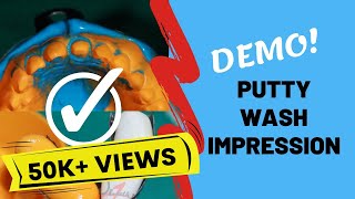 Impression Technique: Putty Wash | CLINICAL DEMO