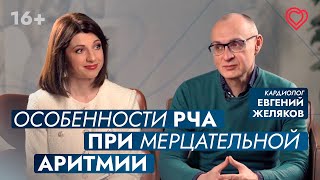 РЧА при мерцательной аритмии: какие особенности? Что делать с пароксизмами и антикоагулянтами?