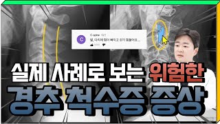 팔 다리 저림? 팔 다리 힘빠짐 증상이 있다면 경추 척수증을 조심하세요!🚑