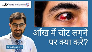 आँख में चोट लगने पर क्या करें? | How to handle an eye injury? | Dr Aditya Sethi | ADEH