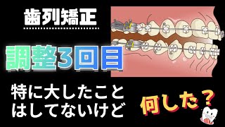 【歯列矯正】3回目の調整に3週間前に行ってきたけど、特に大したことはしていない話