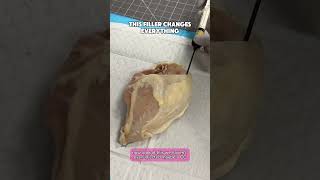 This Filler Changes Everything (Alloclae Demo) | Dr. Matthew J. Nykiel