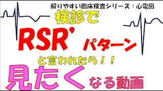 超わかりゃすい臨床検査　心電図　検診でRSRパターン